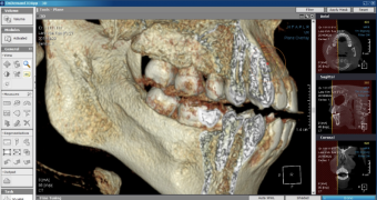 Томограф HDX Will Dentri 3D Classic 16x8