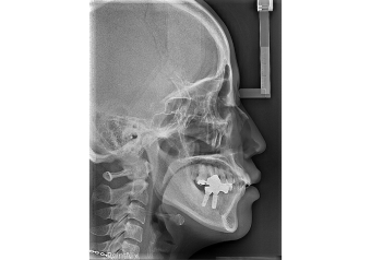 Томограф PointNix 3D Combi 500 16x15