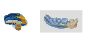 Лабораторный сканер Medit Т-510