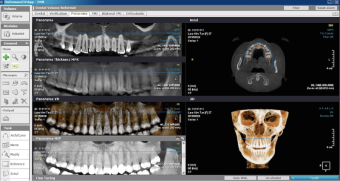 Томограф HDX Will Dentri 3D Classic 16x8