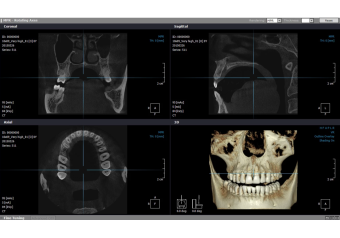 Томограф PointNix 3D Combi 500 16x15