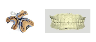 Лабораторный сканер Medit Т-710